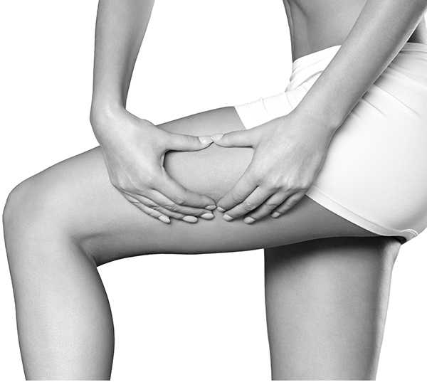 Cellulite