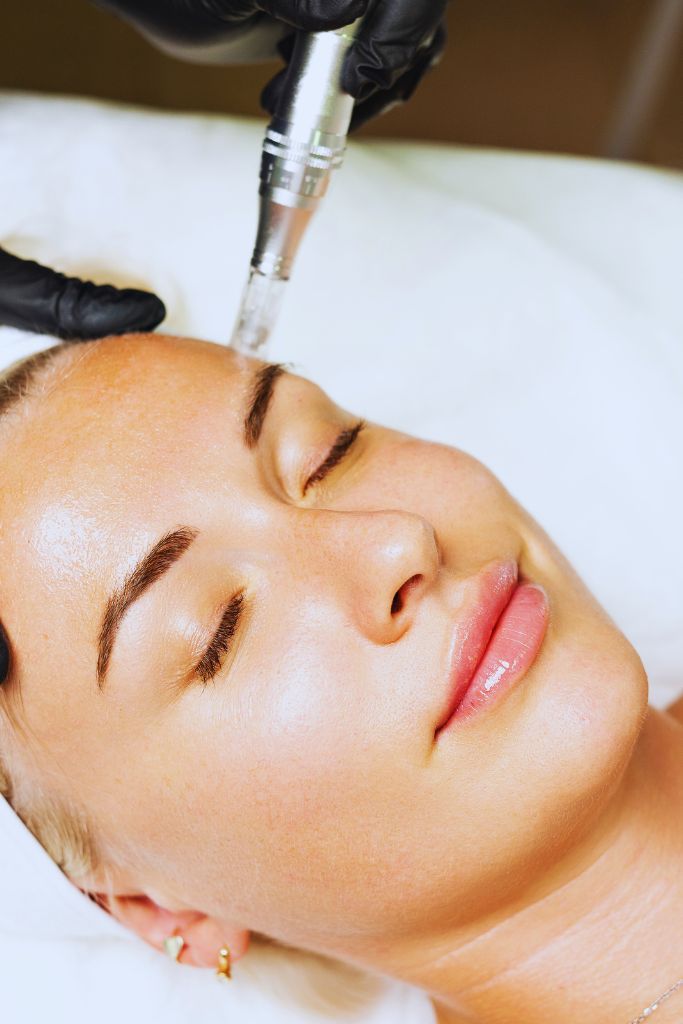 Traitement cicatrices microneedling