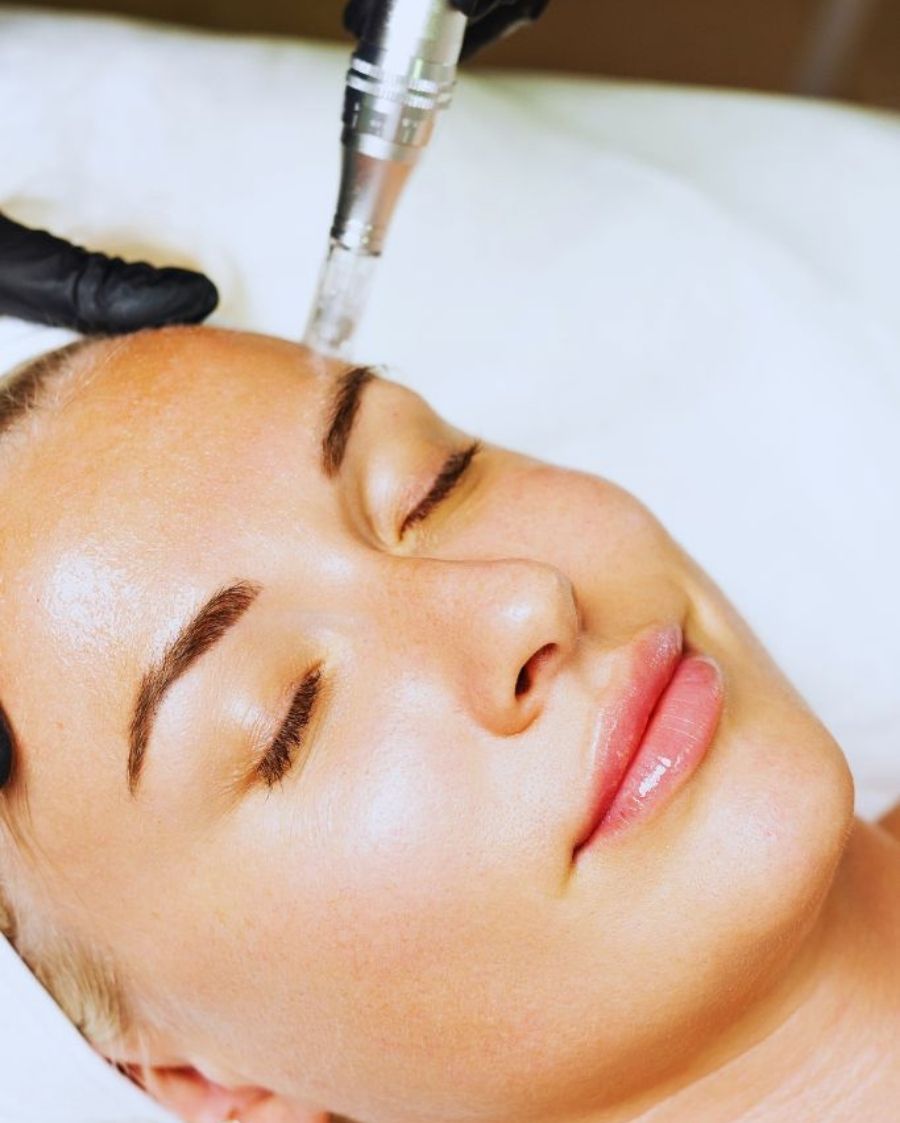 Micro-aiguillage pour la texture de peau